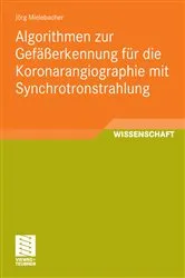 Book cover of Algorithmen zur Gefäßerkennung für die Koronarangiographie mit Synchrotronstrahlung by Unknown