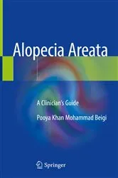 Book cover of Alopecia Areata by Pooya Khan Mohammad Beigi