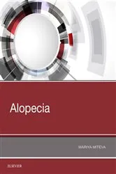 Book cover of Alopecia by Mariya I Miteva