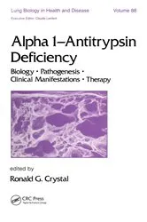 Book cover of Alpha-1-Antitrypsin Deficiency by Pavel Strnad