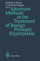 Book cover of Alternate Methods in the Treatment of Benign Prostatic Hyperplasia by Nicholas A. Romas