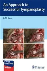 Book cover of An Approach to Successful Tympanoplasty by B M Gupta