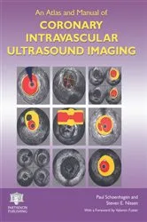 Book cover of An Atlas and Manual of Coronary Intravascular Ultrasound Imaging by Paul Schoenhagen