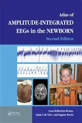Book cover of An Atlas of Amplitude-Integrated EEGs in the Newborn (2nd ed.) by Lena Hellström-Westas