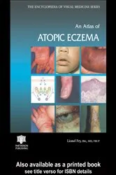 Book cover of An Atlas of Atopic Eczema by Lionel Fry