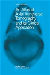 Book cover of An Atlas of Axial Transverse Tomography and its Clinical Application by Shinji Takahashi