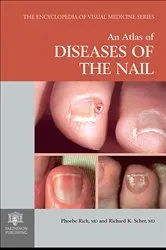 Book cover of An Atlas of Diseases of the Nail by Phoebe Rich