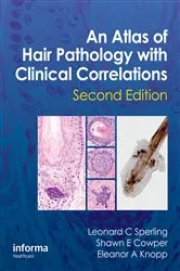 Book cover of An Atlas of Hair Pathology with Clinical Correlations (2nd ed.) by Leonard C Sperling