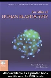 Book cover of An Atlas of Human Blastocysts by Lucinda L. Veeck