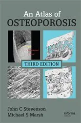 Book cover of An Atlas of Osteoporosis (3rd ed.) by John C. Stevenson