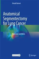 Book cover of Anatomical Segmentectomy for Lung Cancer by Hiroaki Nomori