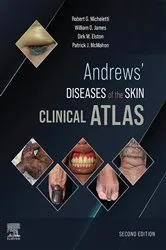 Book cover of Andrews' Diseases of the Skin Clinical Atlas,E-Book (2nd ed.) by Robert G. Micheletti MD