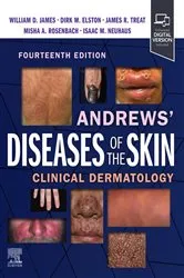 Book cover of Andrews' Diseases of the Skin E-Book (14th ed.) by William D. James MD