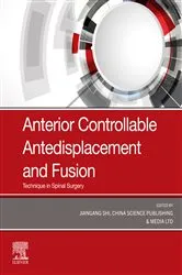 Book cover of Anterior Controllable Antedisplacement and Fusion (ACAF) by Jiangang Shi