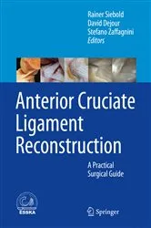 Book cover of Anterior Cruciate Ligament Reconstruction by Rainer Siebold