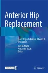 Book cover of Anterior Hip Replacement by Joel M. Matta