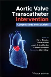 Book cover of Aortic Valve Transcatheter Intervention by Unknown