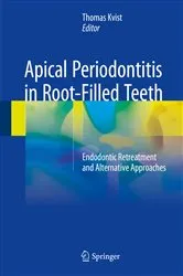 Book cover of Apical Periodontitis in Root-Filled Teeth by Thomas Kvist