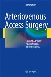 Book cover of Arteriovenous Access Surgery by Hans Scholz