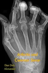 Book cover of Arthritis and Common Sense by Dan Dale Alexander