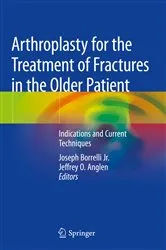 Book cover of Arthroplasty for the Treatment of Fractures in the Older Patient by Unknown