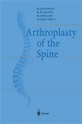 Book cover of Arthroplasty of the Spine by Robert Gunzburg