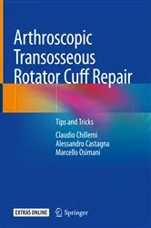 Book cover of Arthroscopic Transosseous Rotator Cuff Repair by Claudio Chillemi