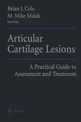 Book cover of Articular Cartilage Lesions by Brian J. Cole