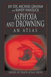 Book cover of Asphyxia and Drowning by Jay Dix