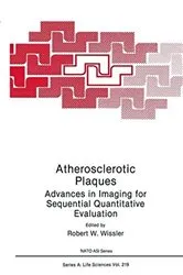 Book cover of Atherosclerotic Plaques by Unknown