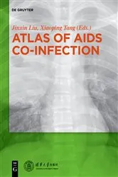 Book cover of Atlas of AIDS Co-infection by Liu Jinxin