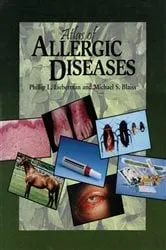 Book cover of Atlas of Allergic Diseases by Phillip Lieberman