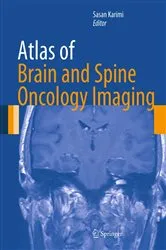 Book cover of Atlas of Brain and Spine Oncology Imaging by Sasan Karimi