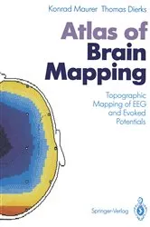 Book cover of Atlas of Brain Mapping by Konrad Maurer