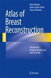 Book cover of Atlas of Breast Reconstruction by Unknown