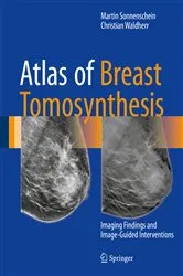 Book cover of Atlas of Breast Tomosynthesis by Martin Sonnenschein
