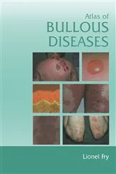 Book cover of Atlas of Bullous Diseases by Lionel Fry