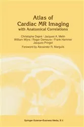 Book cover of Atlas of Cardiac MR Imaging with Anatomical Correlations by C. DeprÃ©