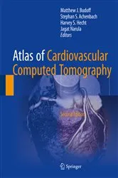 Book cover of Atlas of Cardiovascular Computed Tomography (2nd ed.) by Matthew J. Budoff