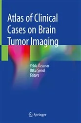 Book cover of Atlas of Clinical Cases on Brain Tumor Imaging by Yelda Özsunar
