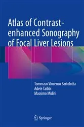 Book cover of Atlas of Contrast-enhanced Sonography of Focal Liver Lesions by Tommaso Vincenzo Bartolotta