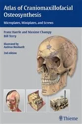 Book cover of Atlas of Craniomaxillofacial Osteosynthesis (2nd ed.) by Franz Härle