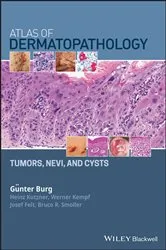 Book cover of Atlas of Dermatopathology by Günter Burg