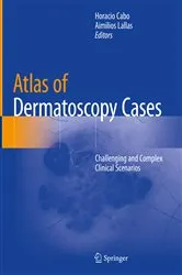 Book cover of Atlas of Dermatoscopy Cases by Unknown