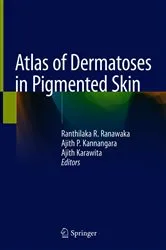Book cover of Atlas of Dermatoses in Pigmented Skin by Ranthilaka R. Ranawaka
