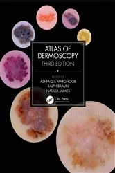 Book cover of Atlas of Dermoscopy (3rd ed.) by Unknown