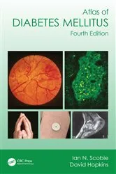 Book cover of Atlas of Diabetes Mellitus (4th ed.) by Ian N. Scobie