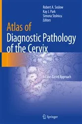 Book cover of Atlas of Diagnostic Pathology of the Cervix by Robert A. Soslow