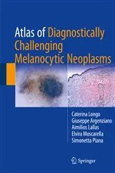 Book cover of Atlas of Diagnostically Challenging Melanocytic Neoplasms by Caterina Longo