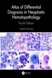 Book cover of Atlas of Differential Diagnosis in Neoplastic Hematopathology (4th ed.) by Unknown
